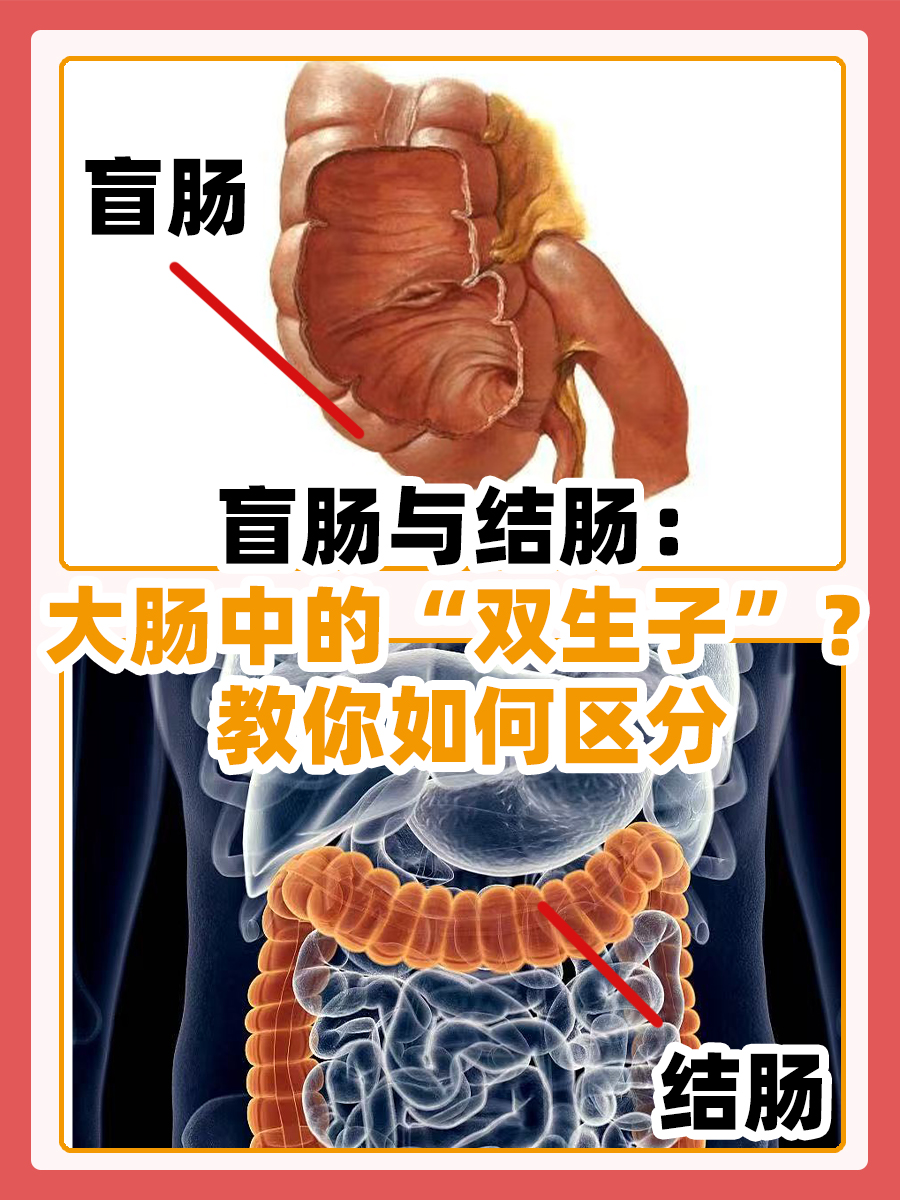 大肠小肠叠在一起怎么办啊(大肠小肠叠在一起怎么办啊视频)