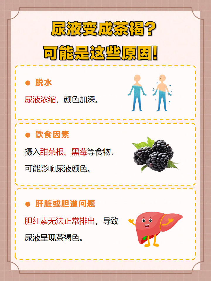 尿液变成茶褐色的原因可能是以下几个: 脱水 饮食因素 肝脏或胆道