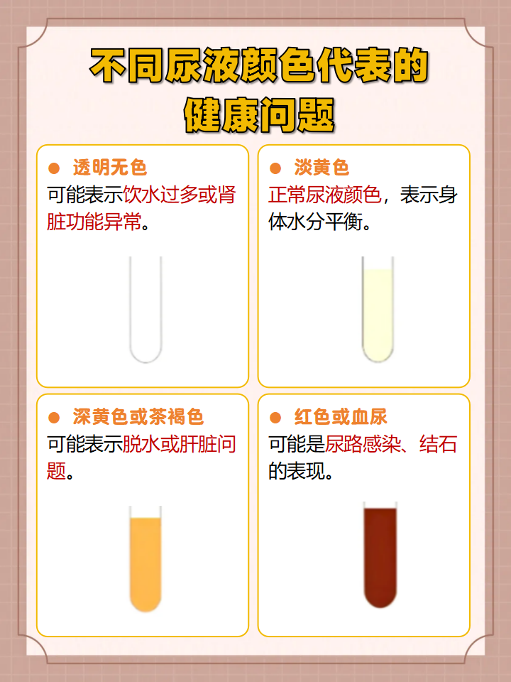 尿液变成茶褐色的原因可能是以下几个: 脱水 饮食因素 肝脏或胆道