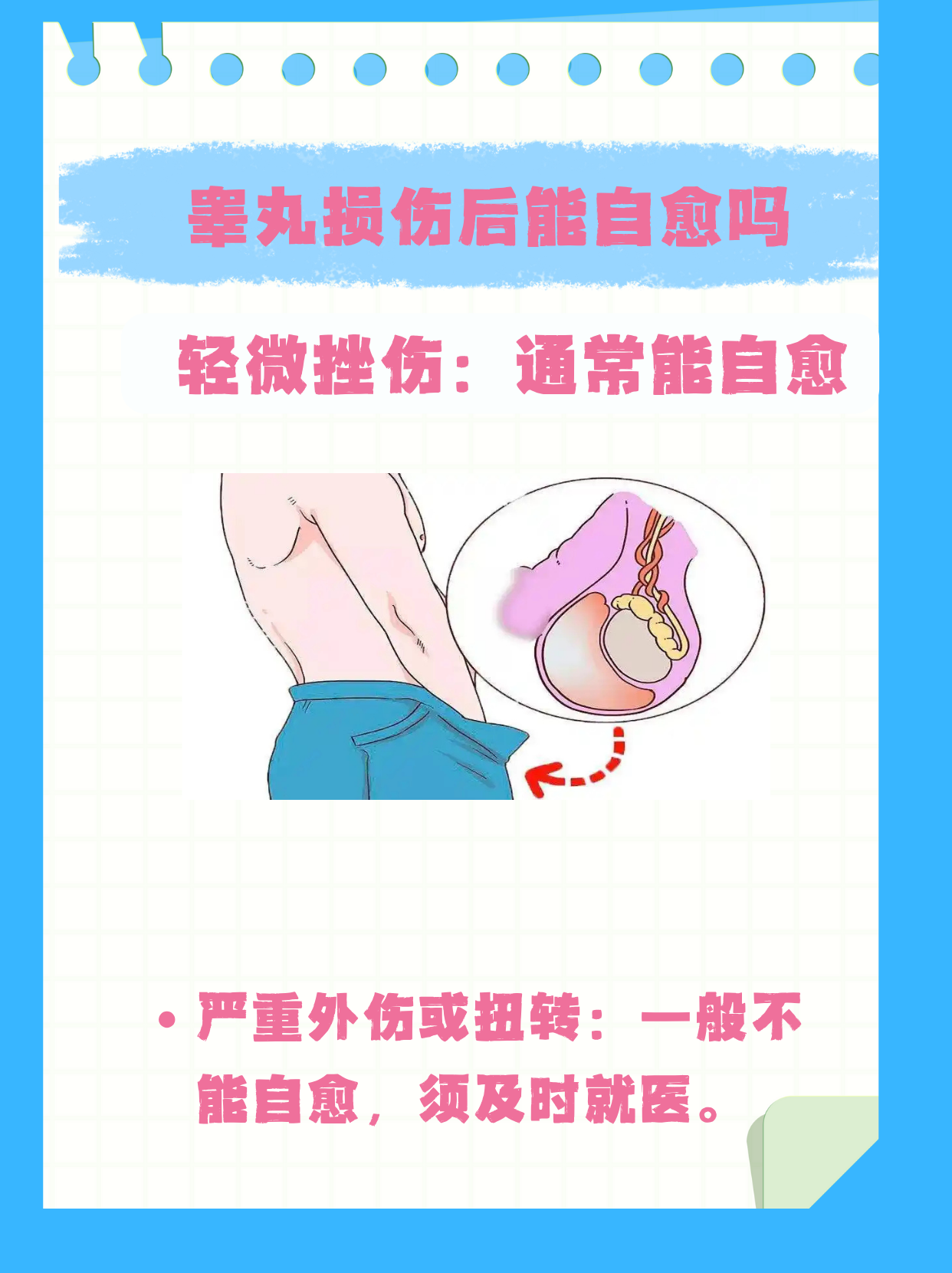 睾丸损伤后能否自愈,关键要看损伤的轻重程度