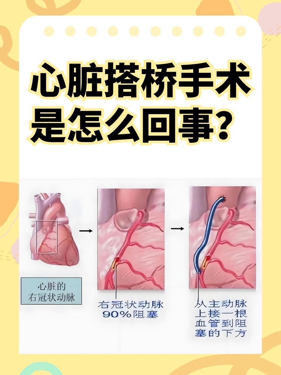 上海市心胸医院：守护心脏健康的力量之源