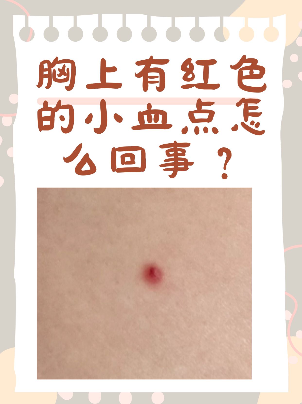 这些小红点究竟是怎么回事呢?让我们一起来了解一下.
