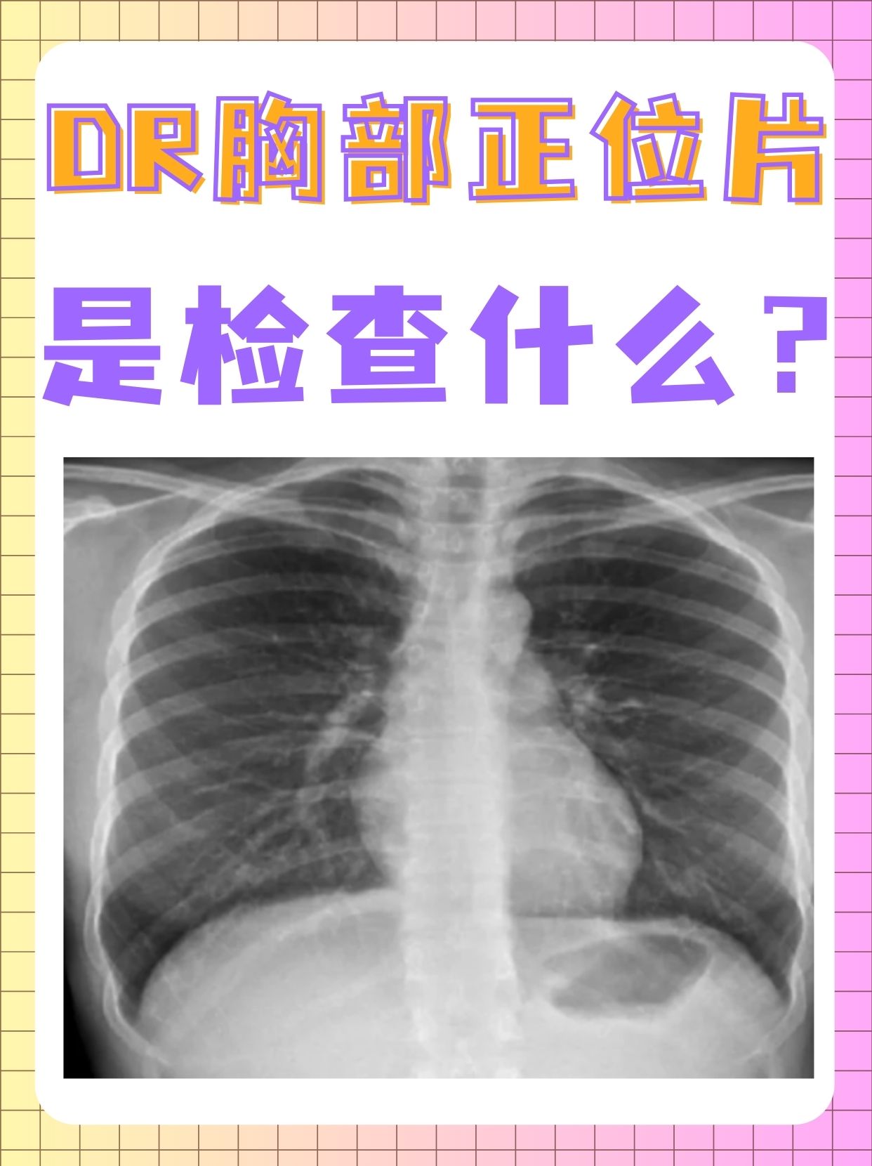 在医院的众多检查项目中