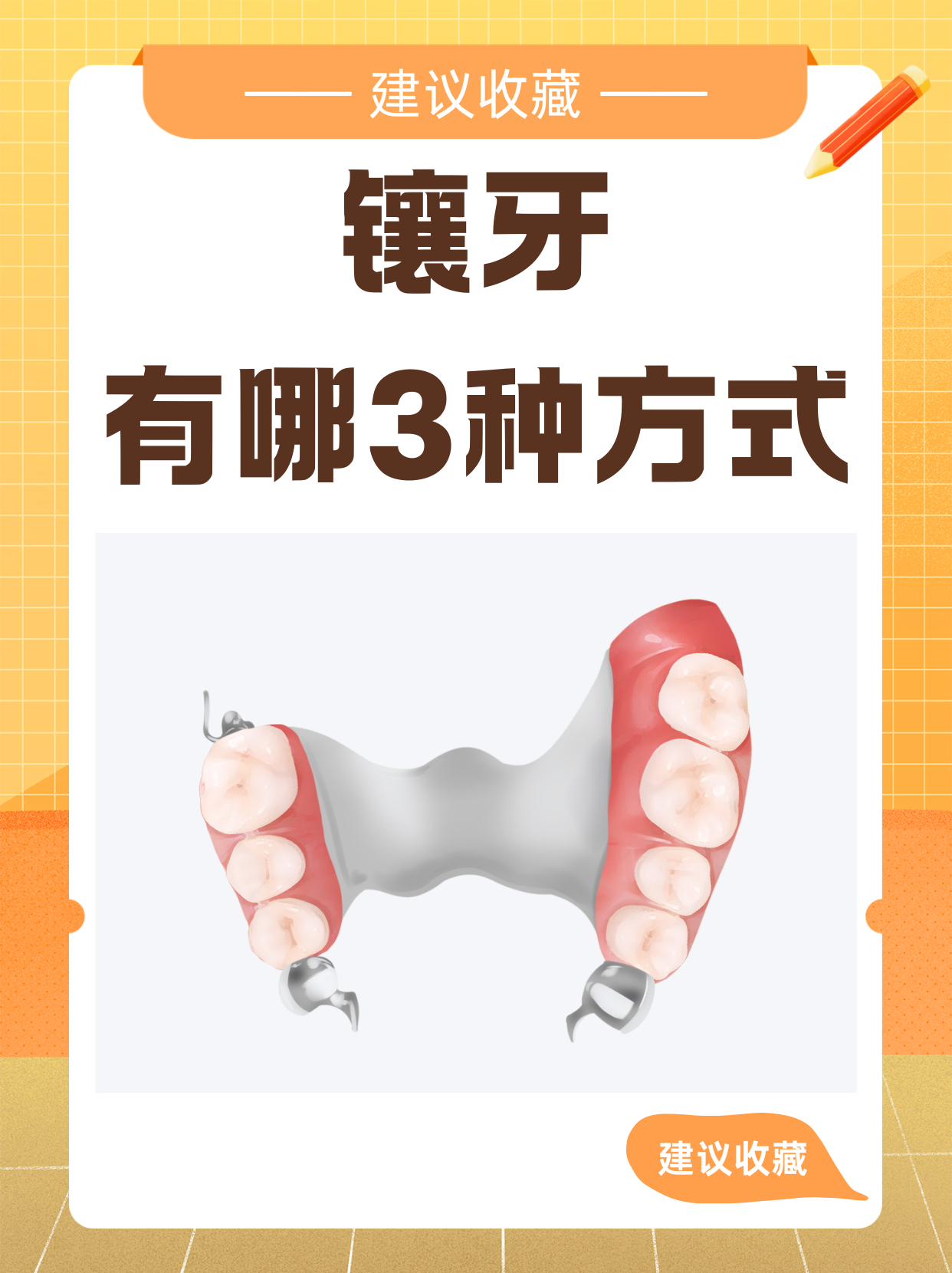 生活中,不少人都可能因为各种原因需要镶牙,然而对
