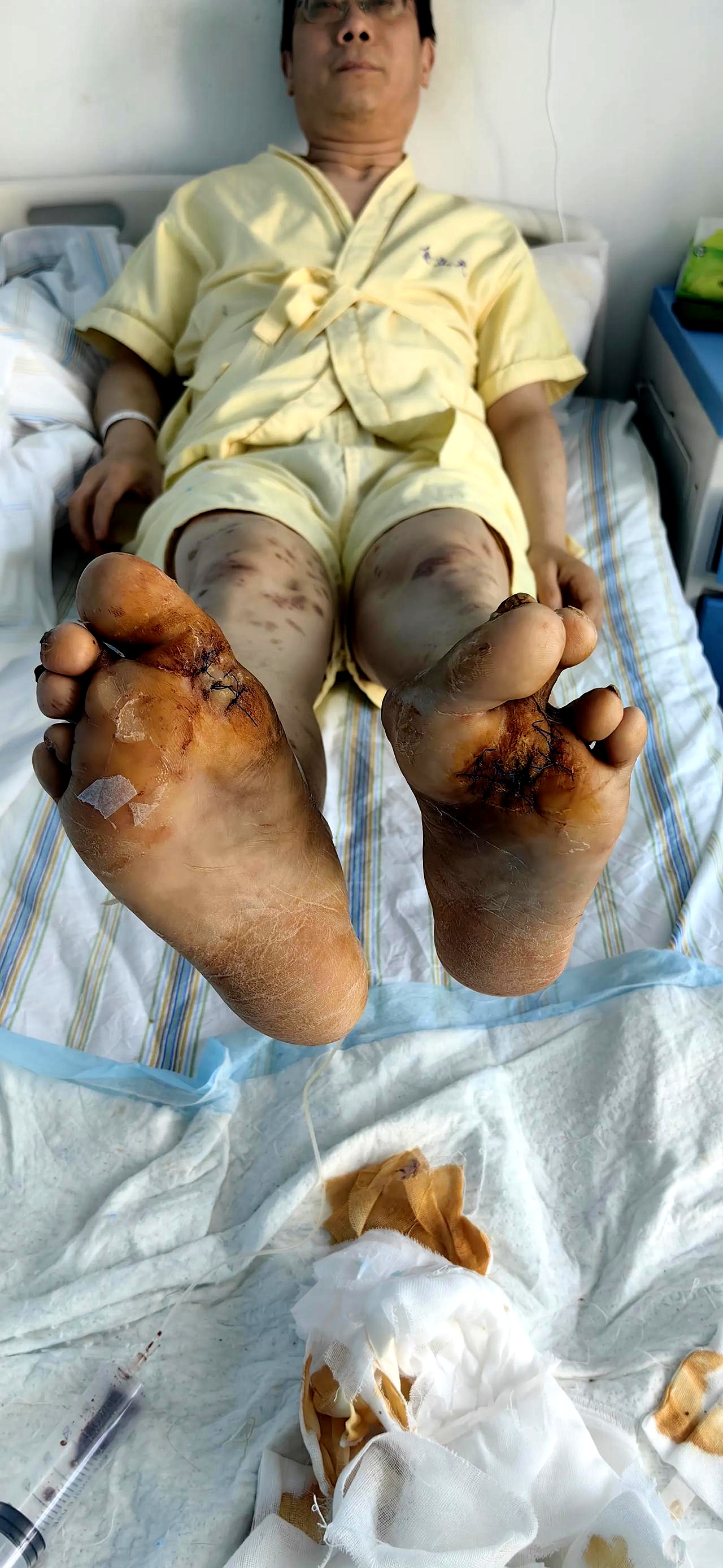 我的脚经常麻麻的,有时候感觉像有小虫在爬,有时候又像没啥感觉