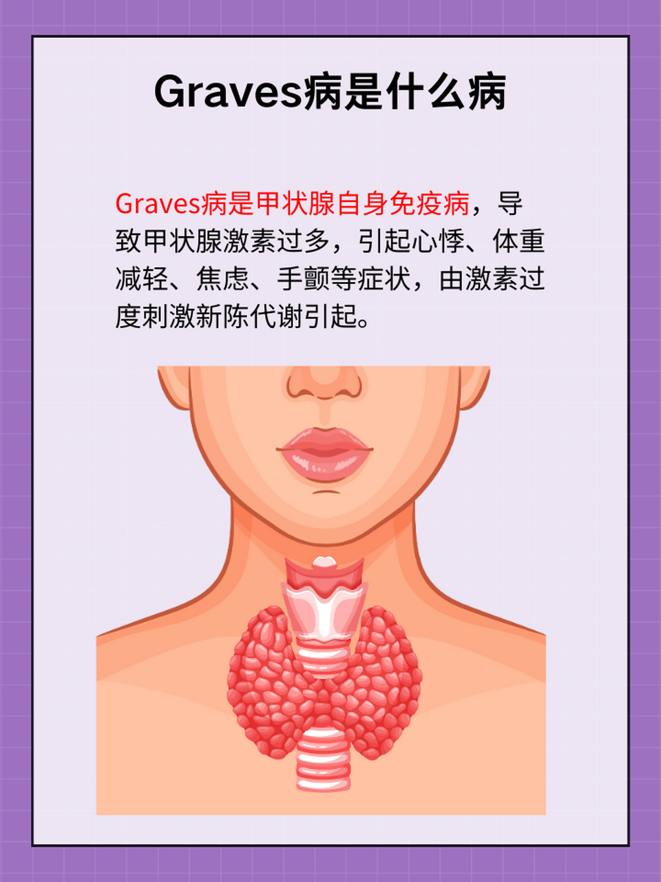 了解graves病的症状,原因及治疗方法对于患者和潜在患者都至关重要.