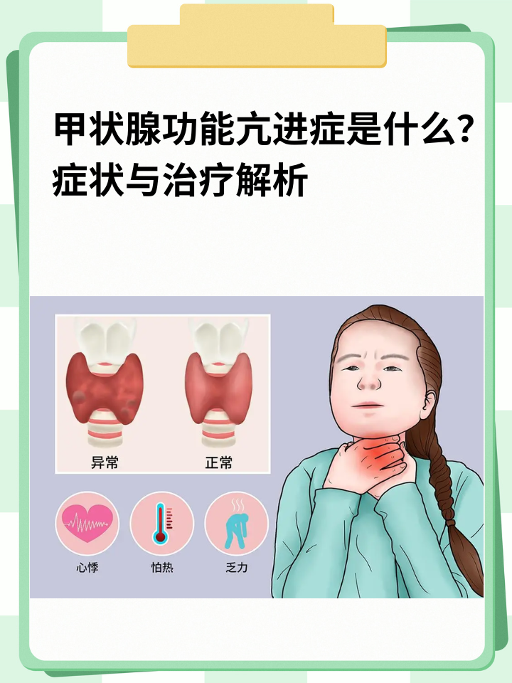 症状与治疗解析 甲状腺功能亢进症,简称甲亢,是一种由甲状腺分泌过多