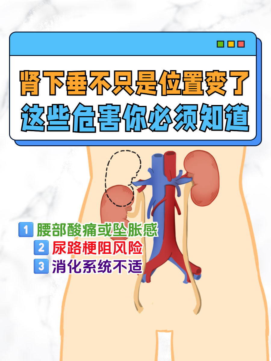 肾下垂不只是位置变了,这些危害你必须知道