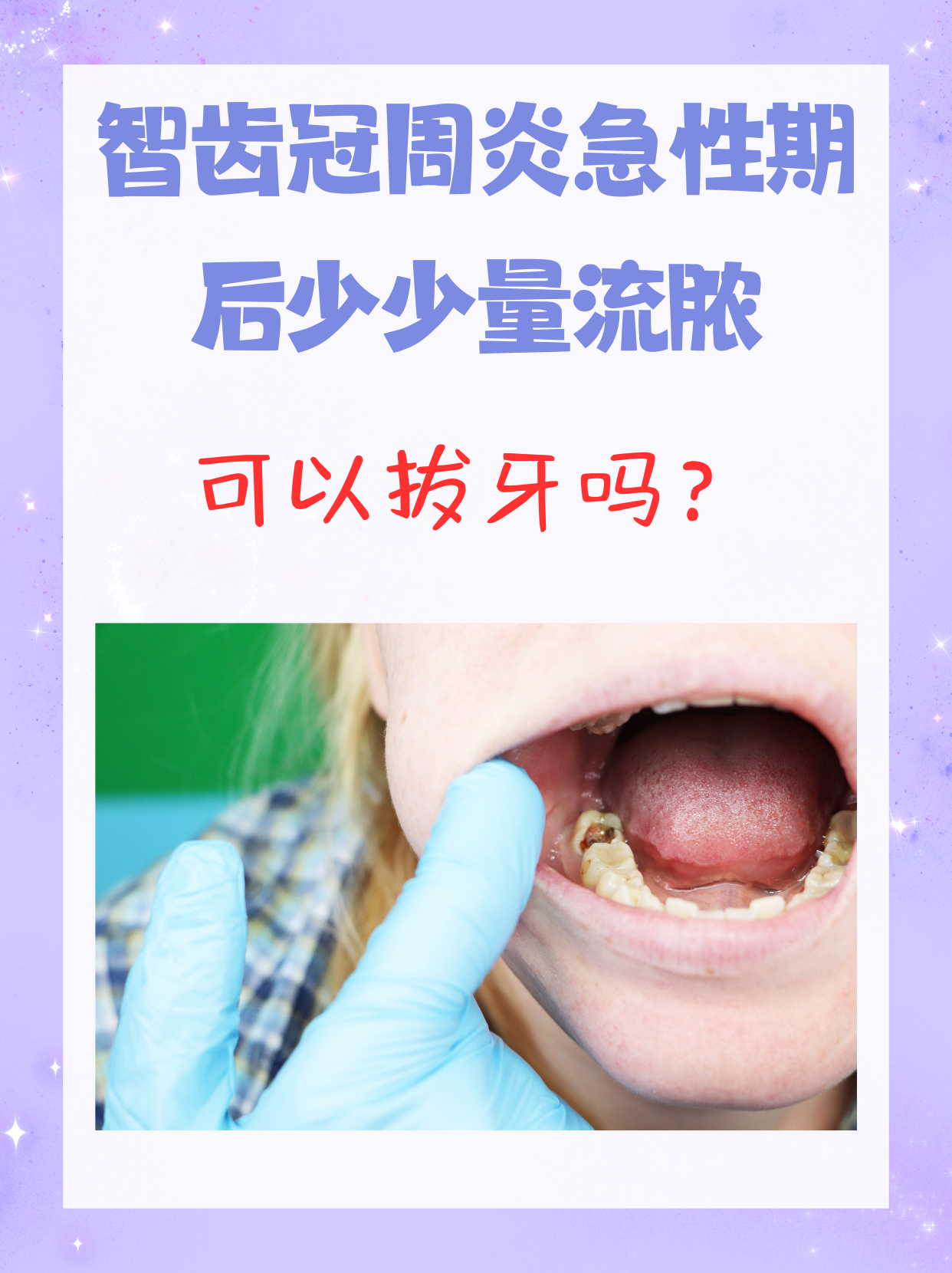 智齿为什么发炎