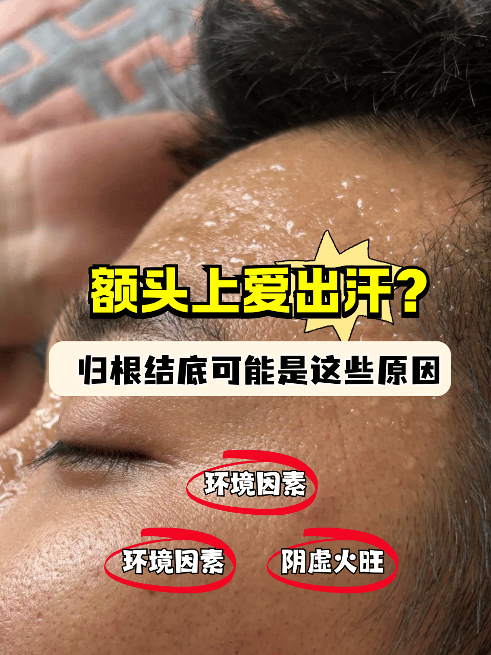为什么一出汗脸就有些痒为什么在线