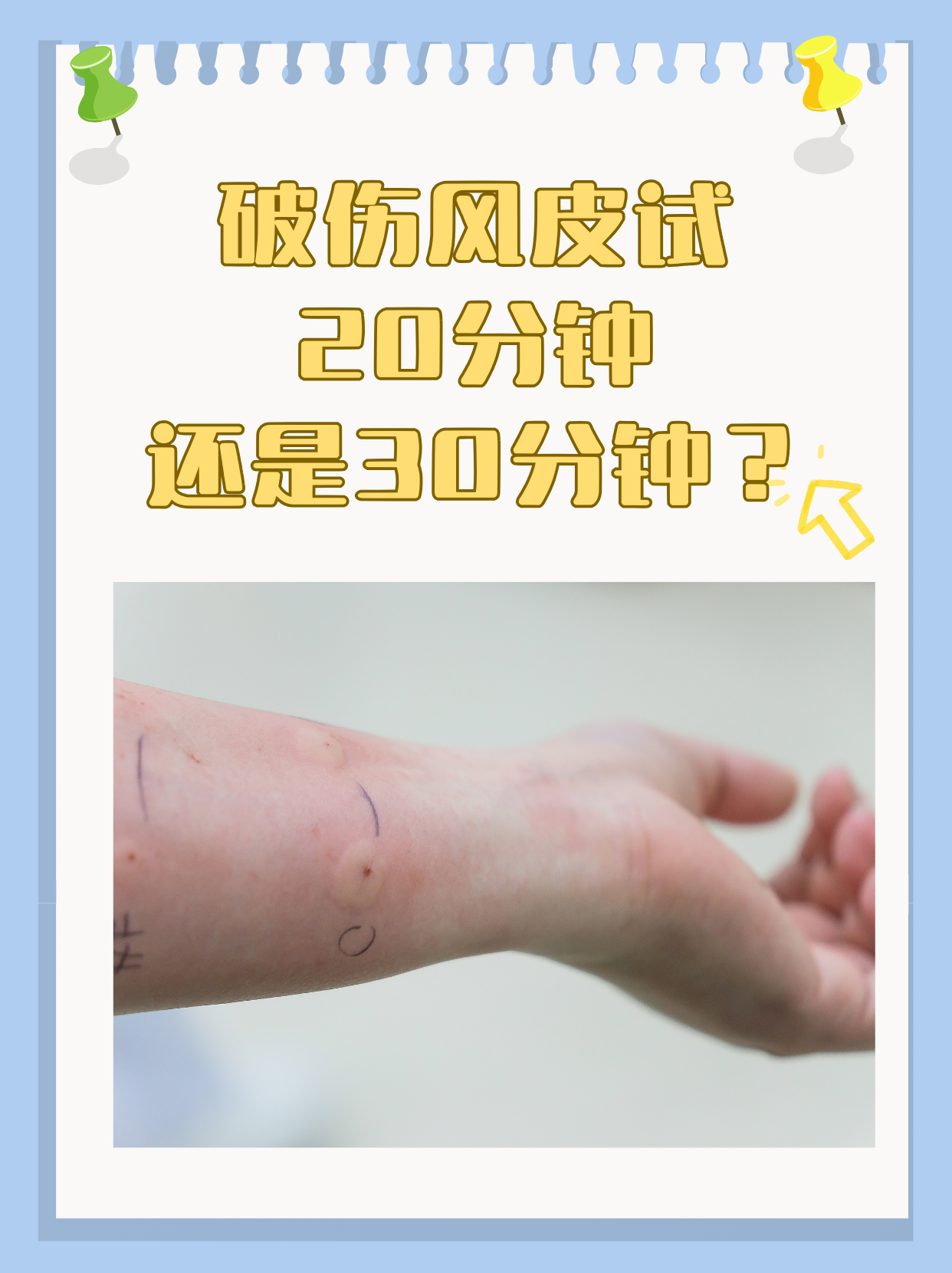 hey,朋友们! 你是不是也对破伤风皮试时间感到困惑?