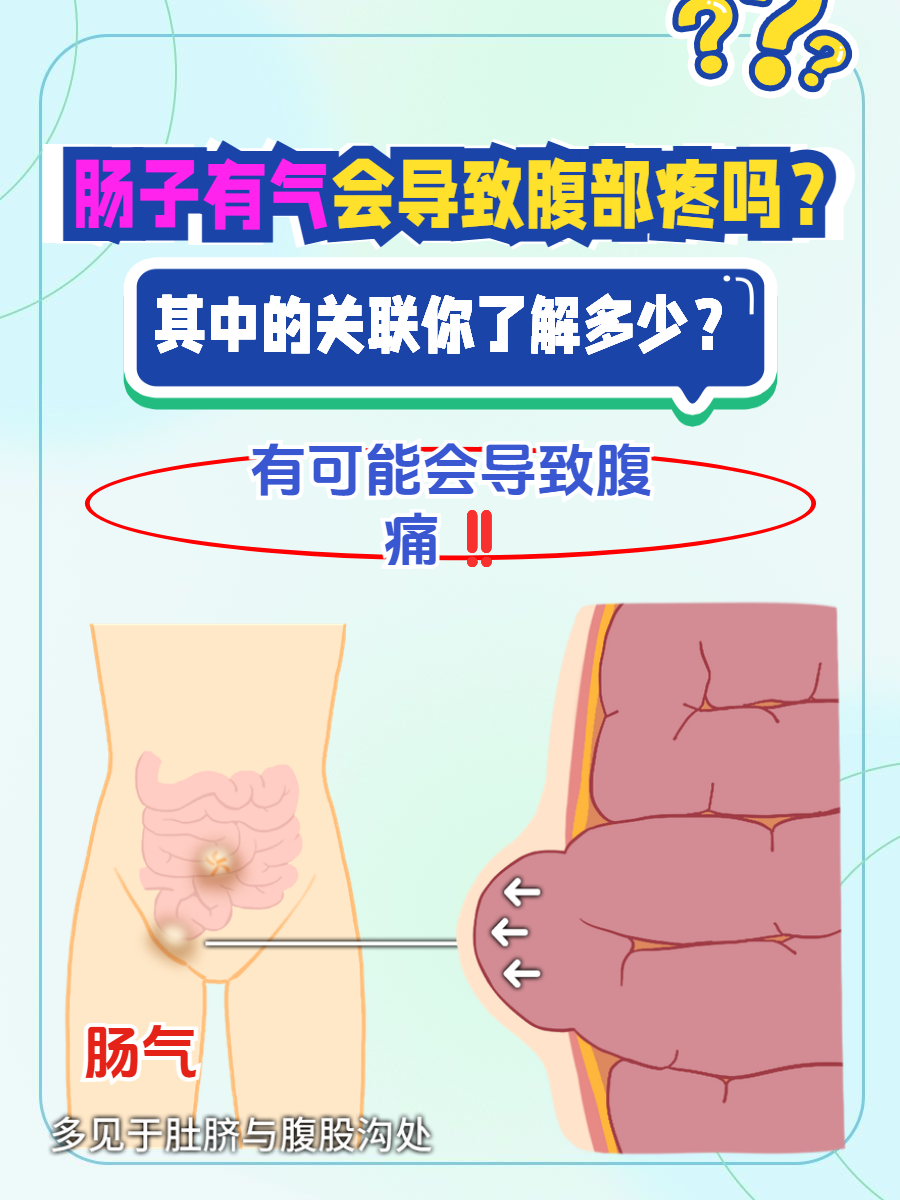 肠子有气会导致腹部疼吗?其中的关联你了解多少?