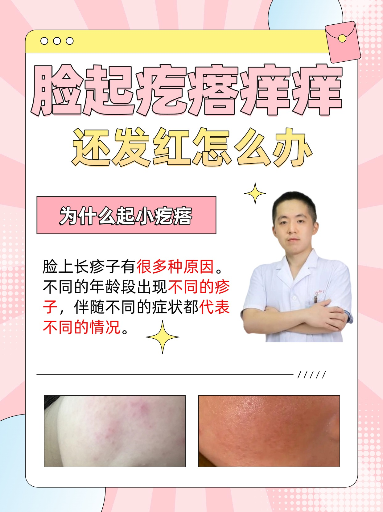 脸为什么会痒