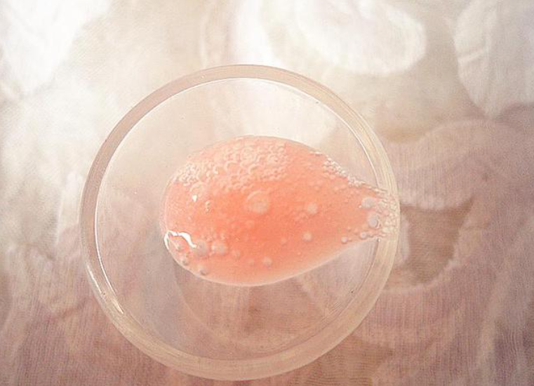 粉红色泡沫样痰常见于哪些疾病