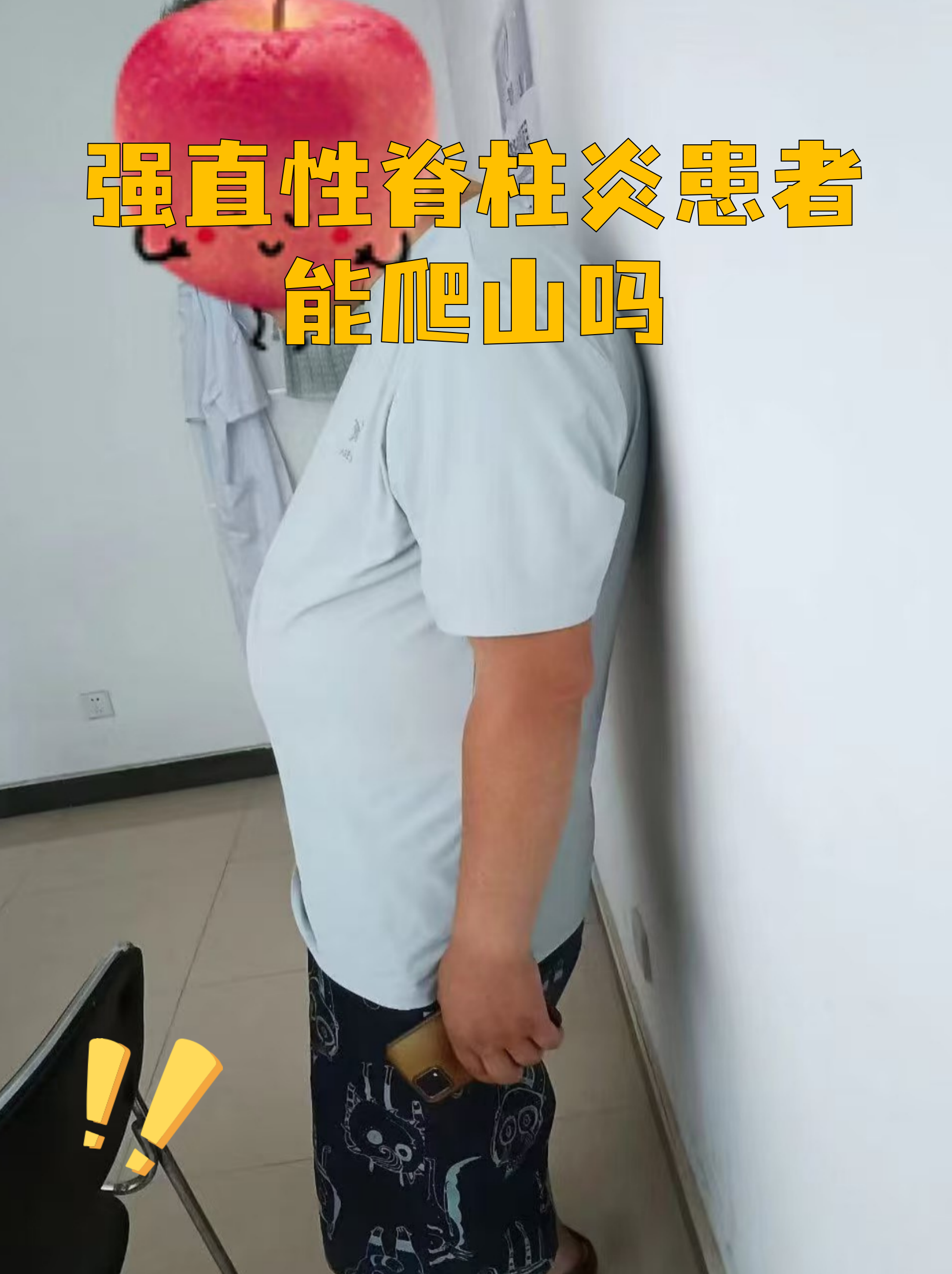 强直性脊柱炎患者能爬山吗