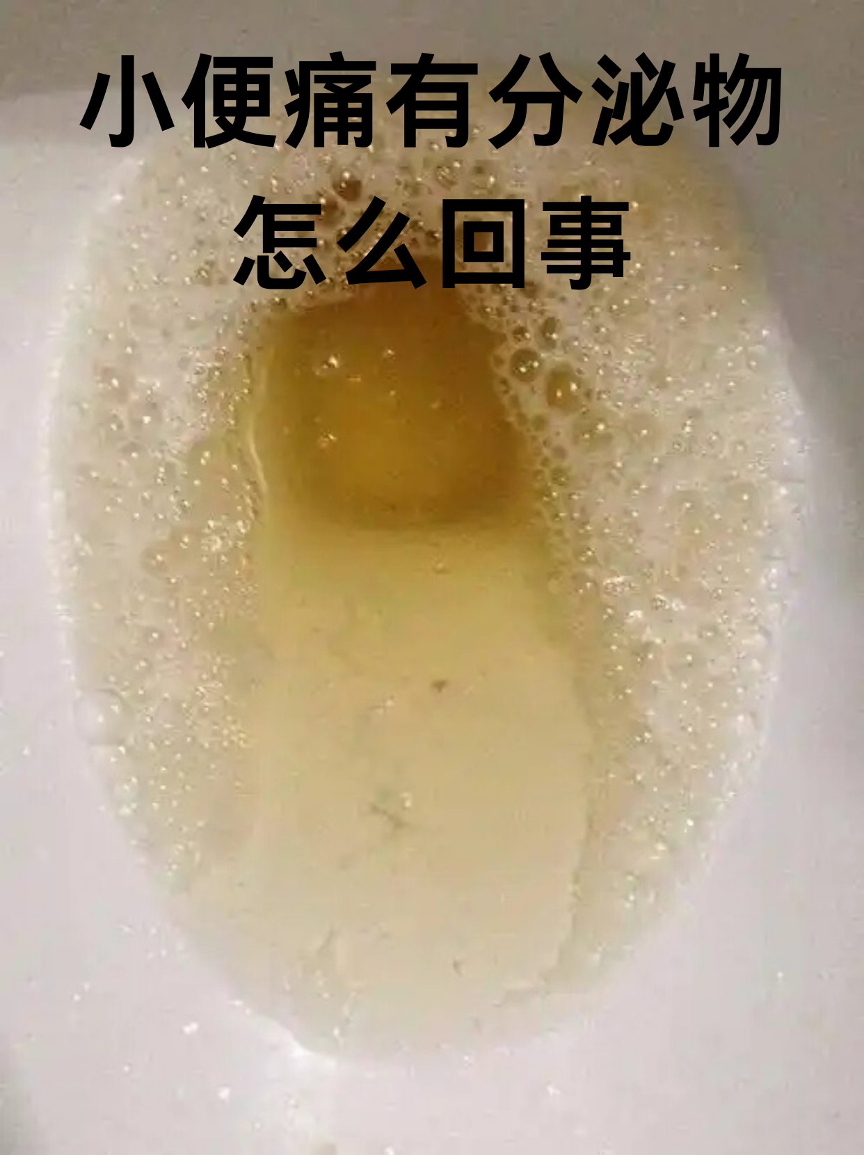 小便痛有分泌物怎么回事