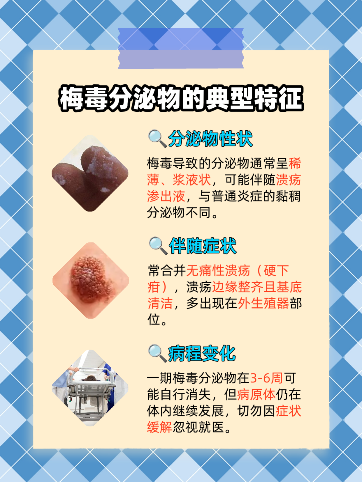 私处有异样分泌物,警惕梅毒