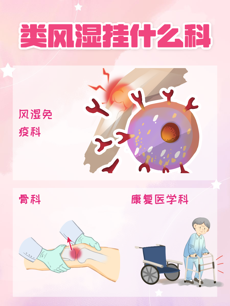 类风湿挂什么科?