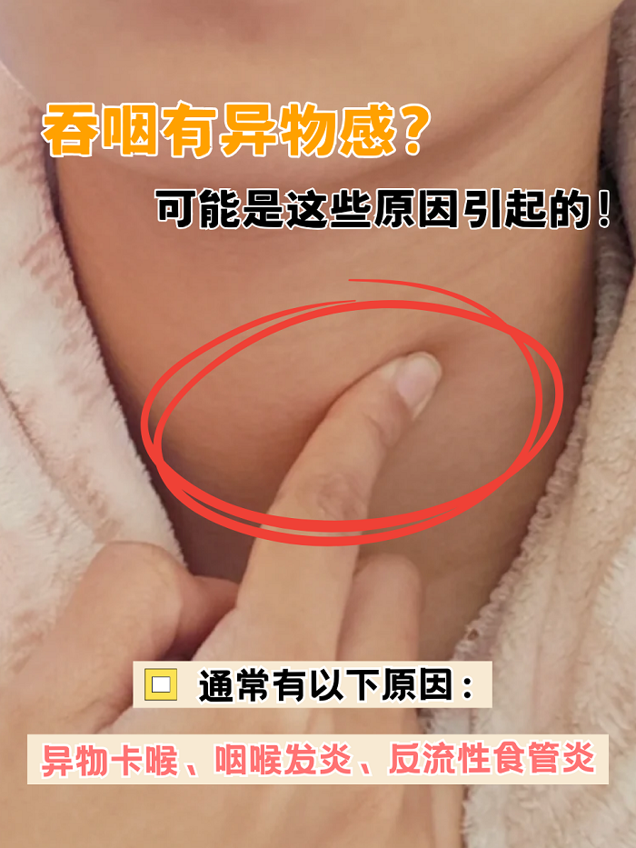 正常压住舌头看到会厌图片喉咙感觉有异物女生喉咙骨头屯萄视幸煳锔 ?