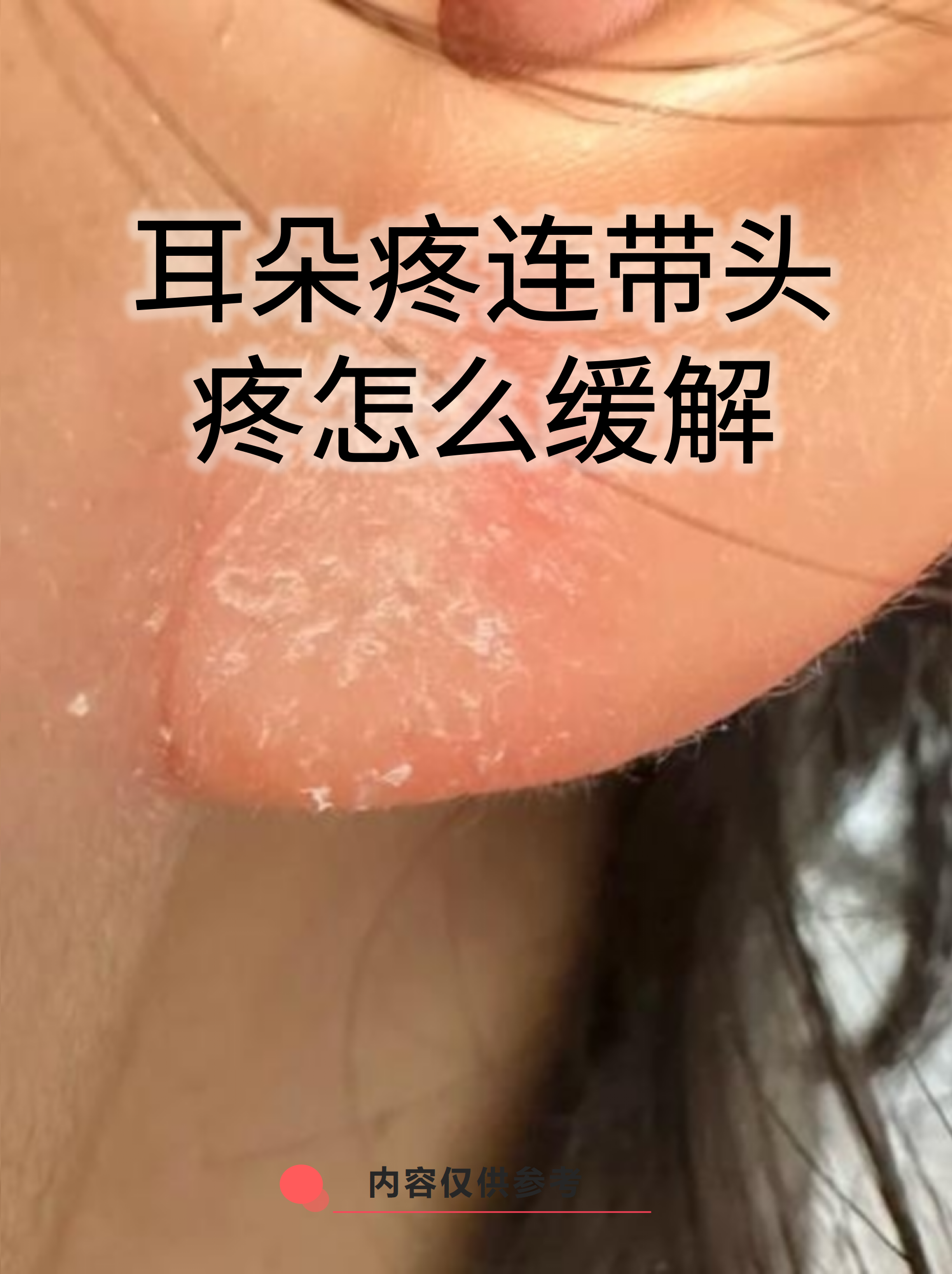 耳朵疼连带头疼怎么缓解