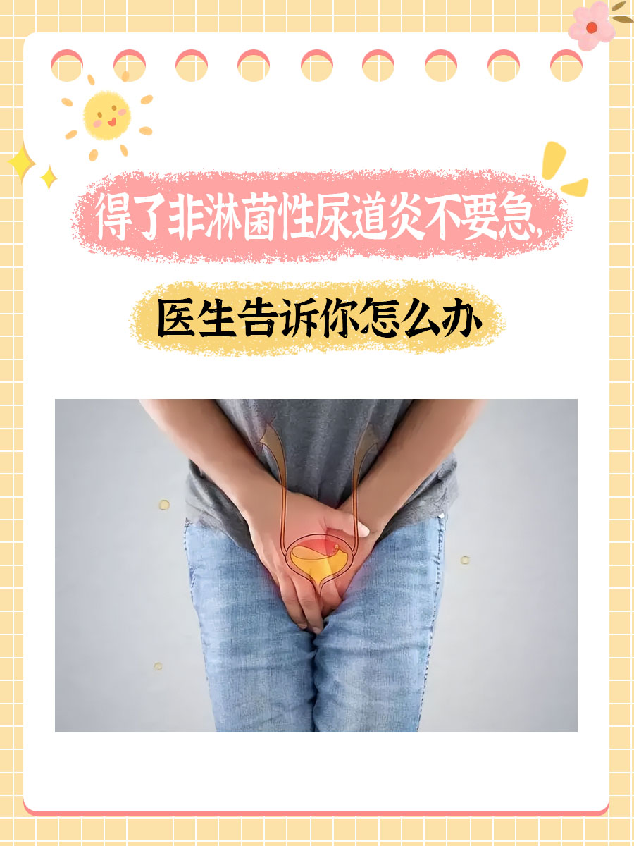 得了非淋菌性尿道炎不要急,医生告诉你怎么办  非淋菌性尿道炎,作为一
