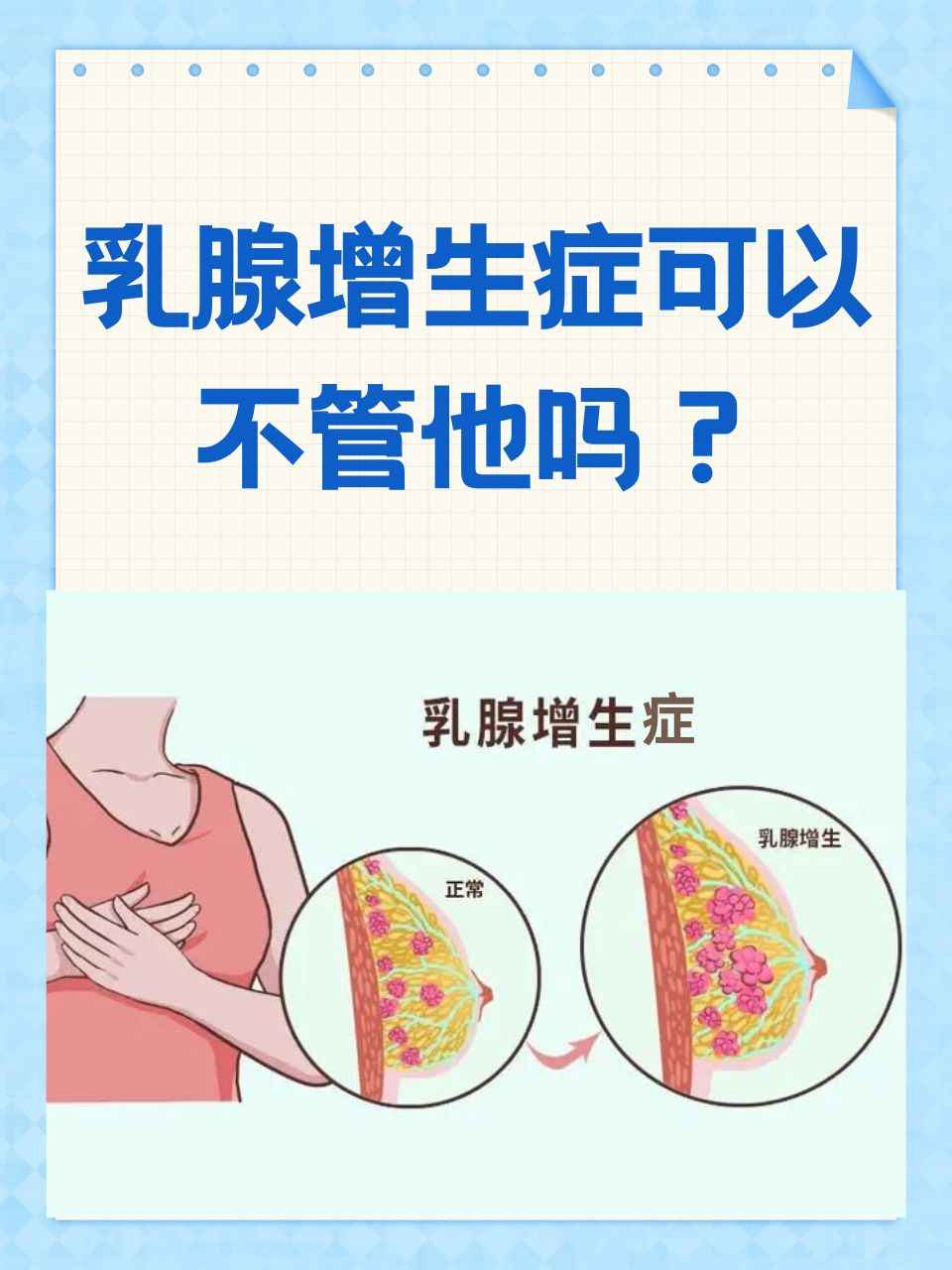 乳腺增生照片图片图片