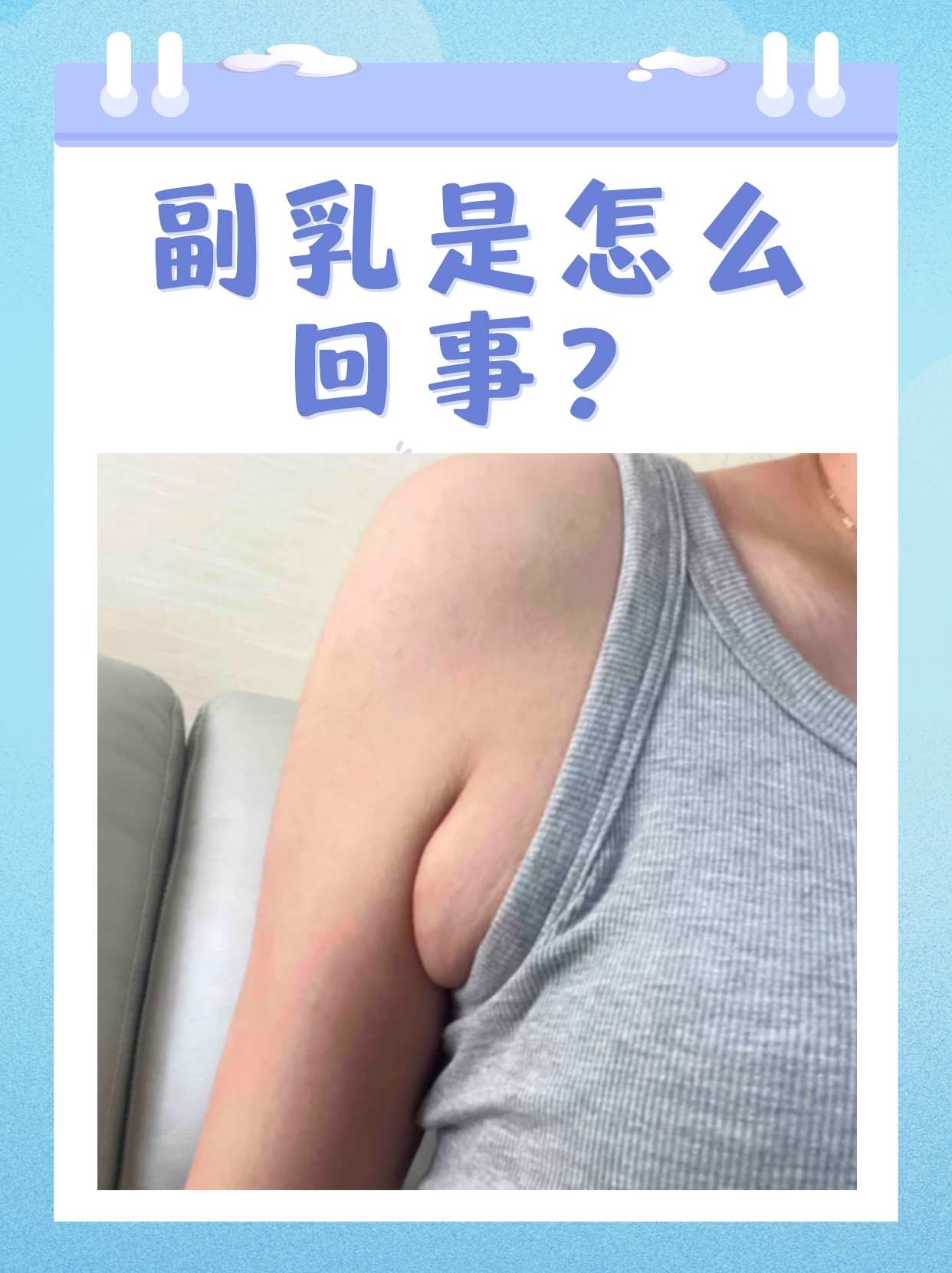 副乳是什么及其图片图片