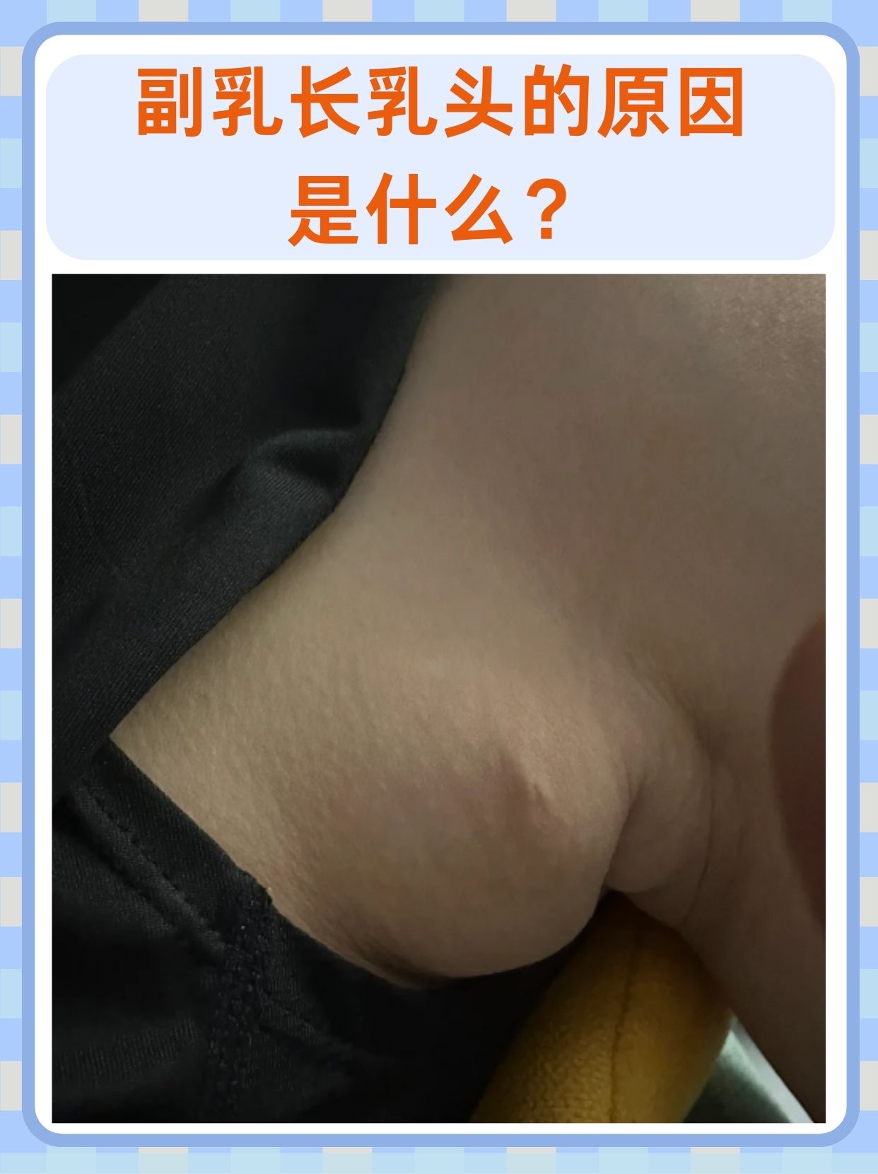 乳头痒是什么原因图片