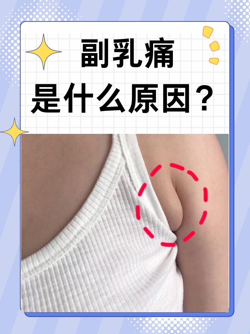 为什么有副乳胸还很大为什么在线