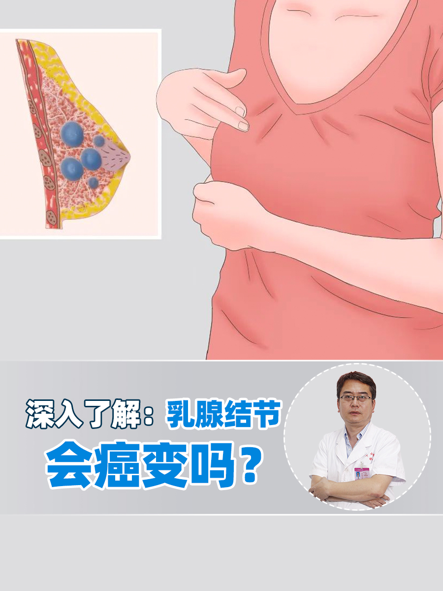 乳腺结节症状图片