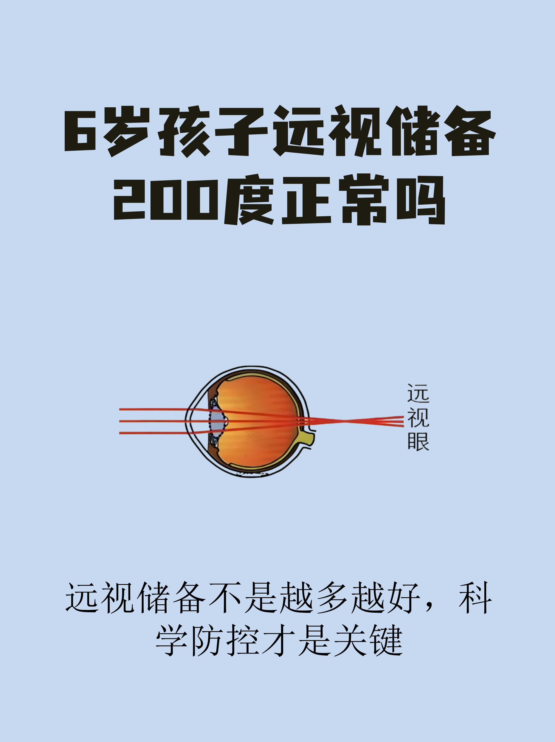 远视储备是儿童视力发育的重要指标,但数值高低需要结合年龄科学判断