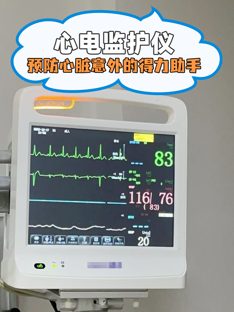 心电监护图片医院心电监护监护仪心脏监测仪监护仪器显示怎么看图解
