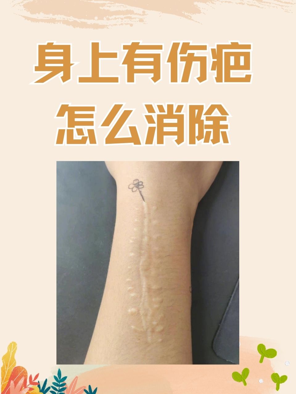 抖音特效刀疤=抖音刀疤特效在哪里