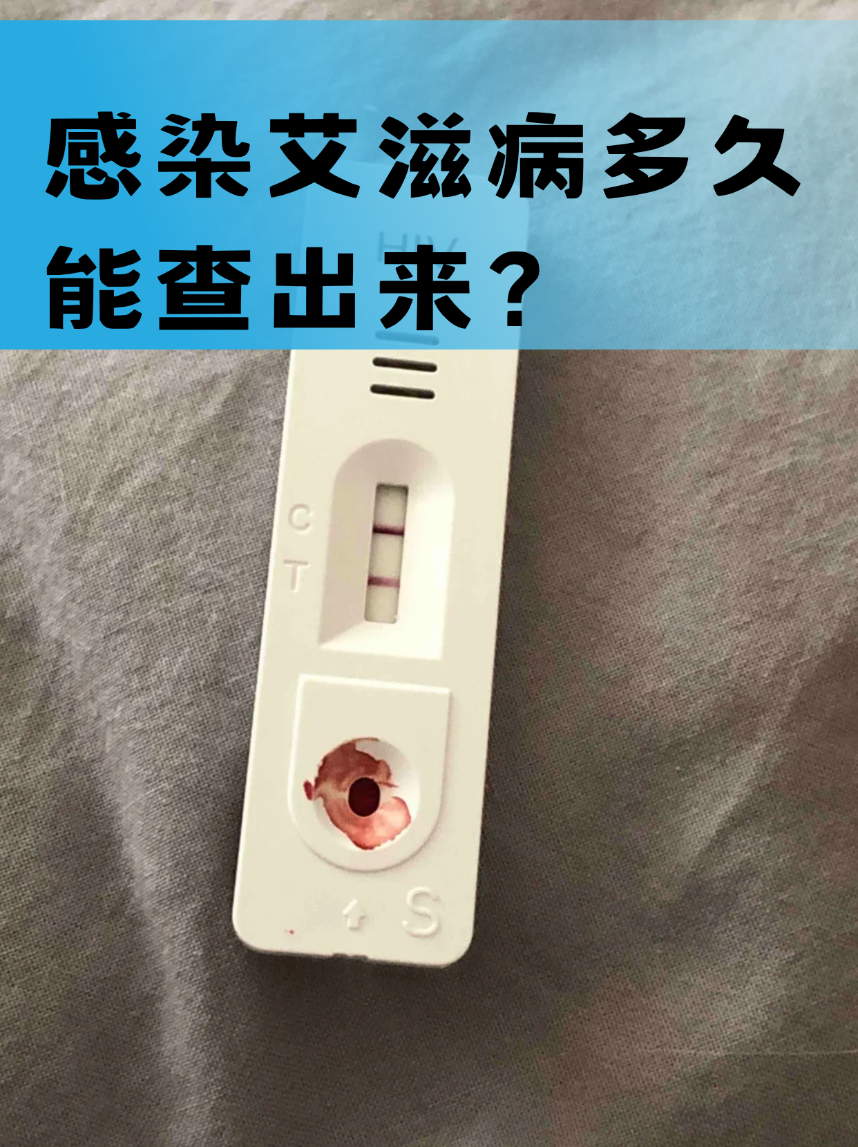 感染艾滋病多久能查出来?