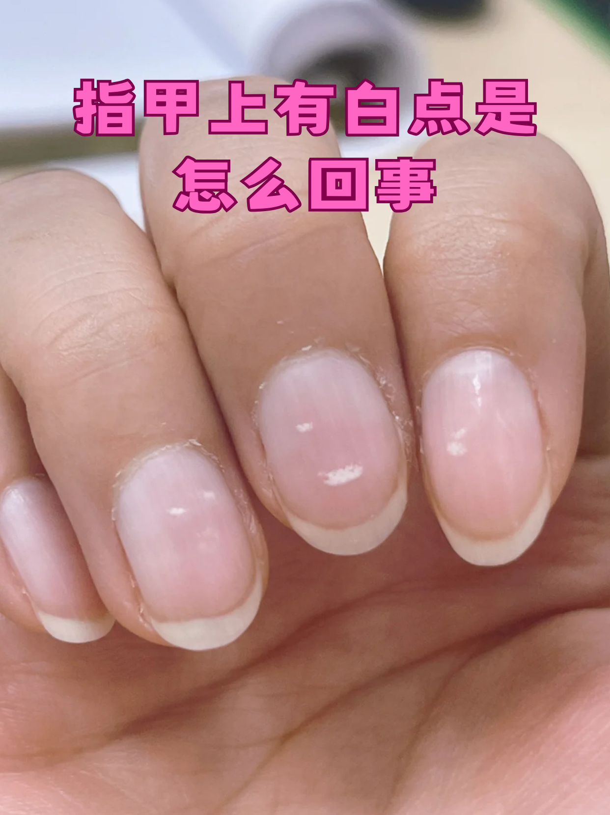 指甲上有白点是怎么回事