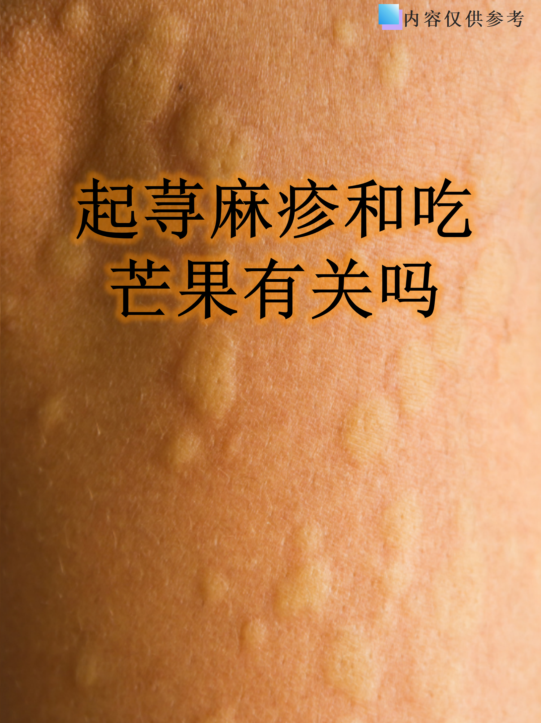 常见诱因分析 食物过敏:芒果含有