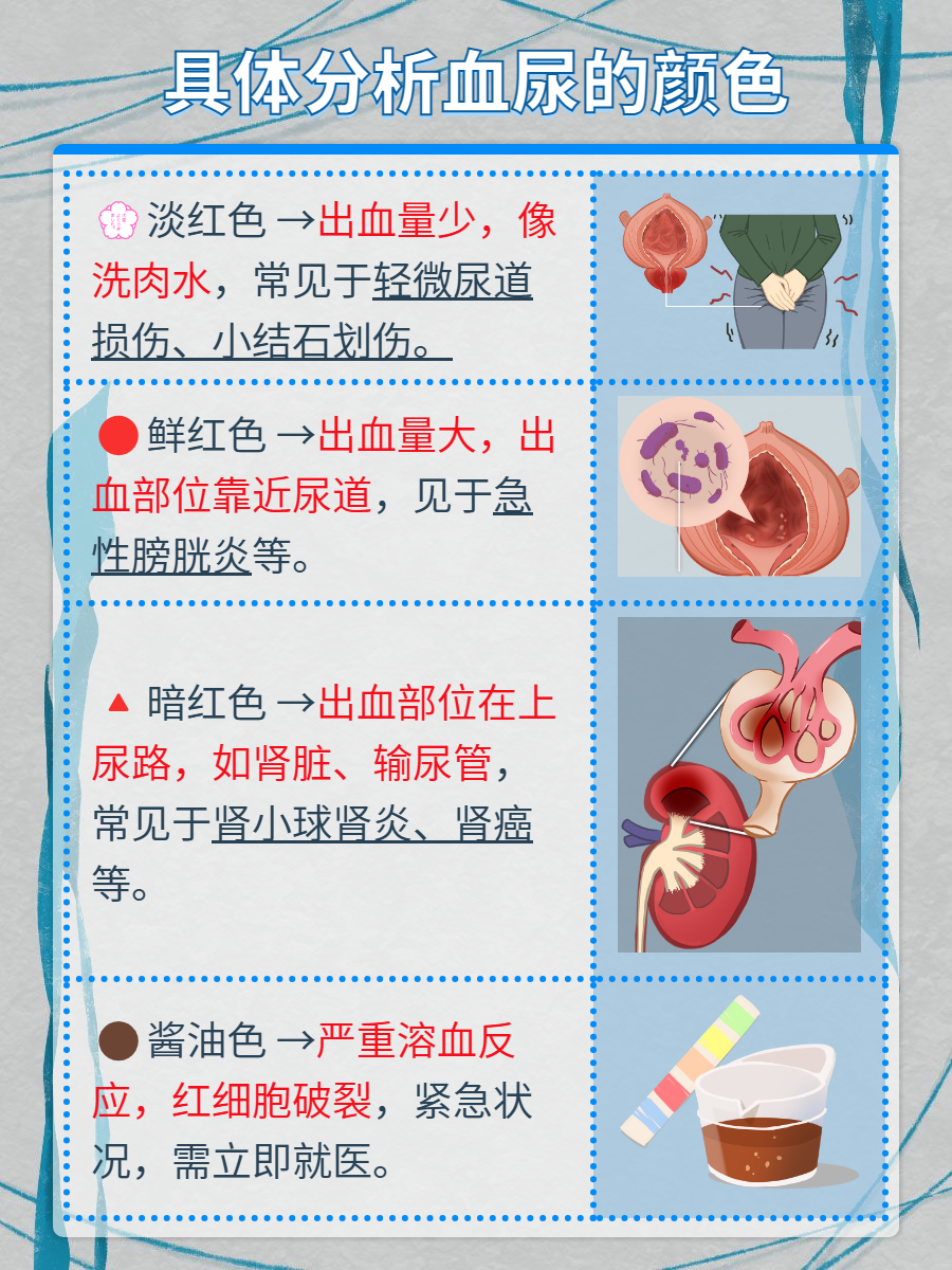 血尿"变色龙":揭秘血尿的多种面貌