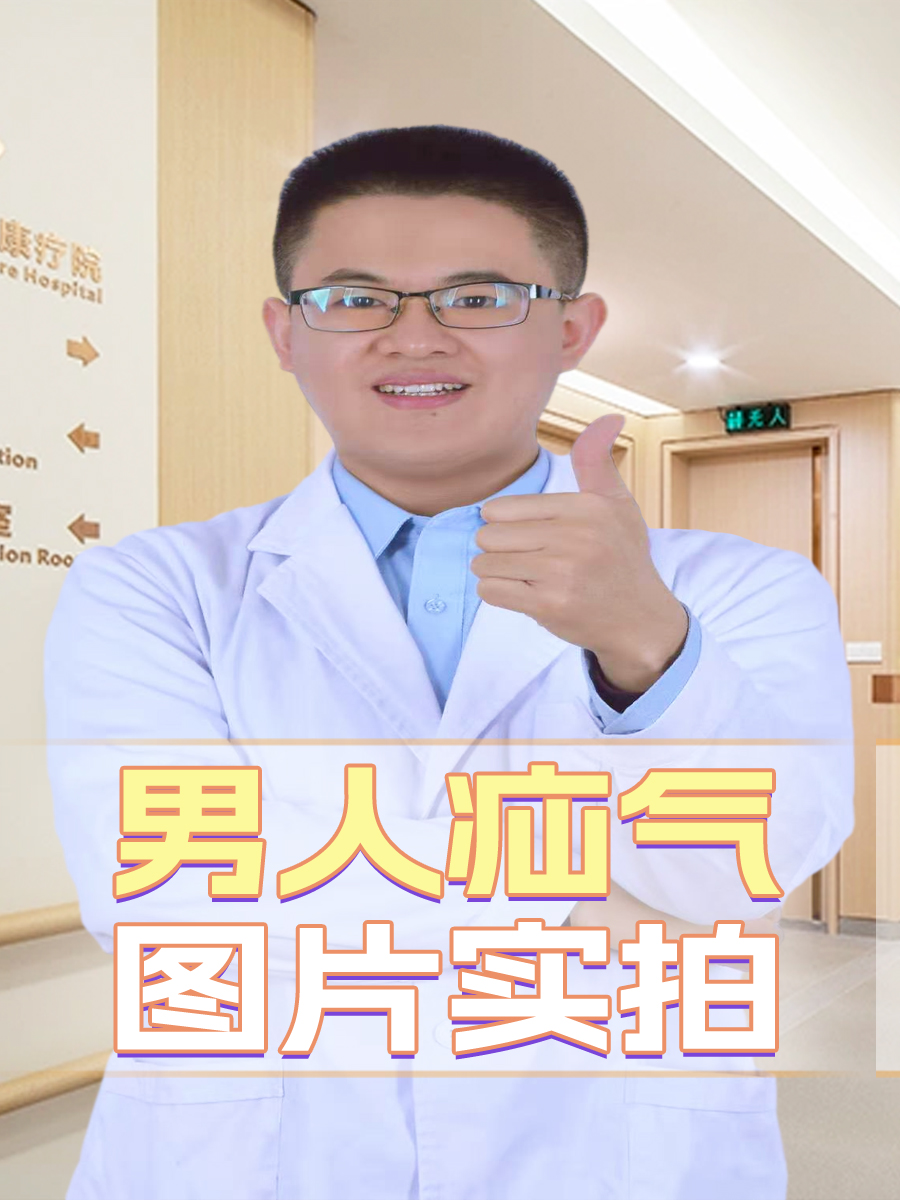 男人疝气的症状主要包括以下几点:  腹部疼痛或不适:尤其