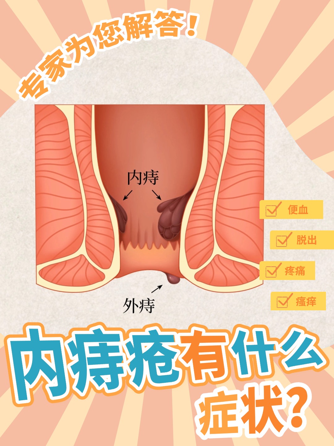 女人为什么会有痔疮