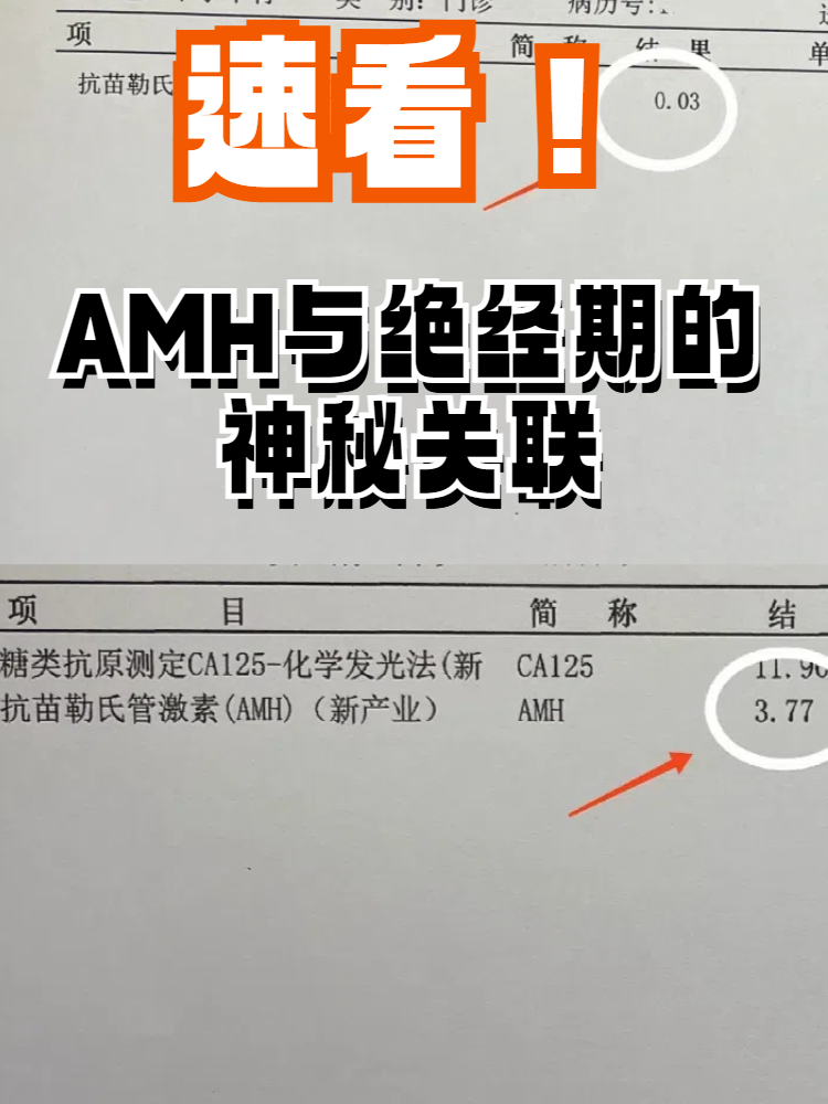 抗缪勒氏管激素amh(抗缪勒氏管激素amh值偏高)