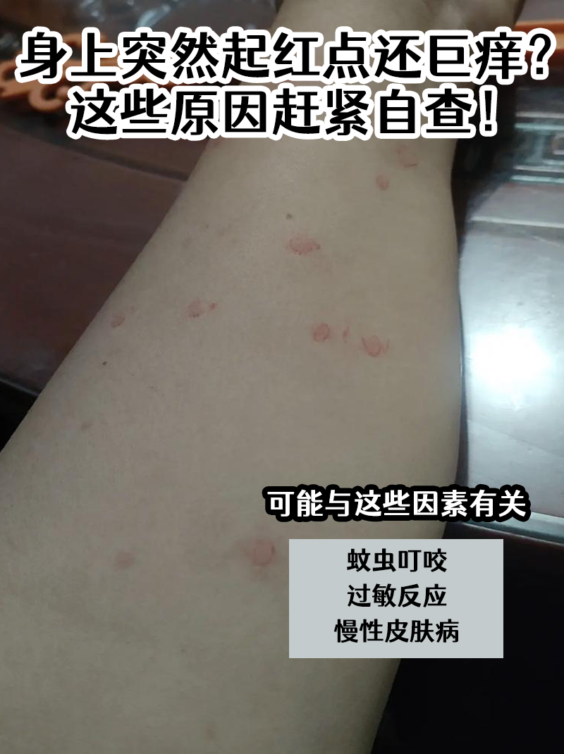 症状螨虫过敏图片和症状图螨虫咬过的皮肤图粕砩贤蝗黄鸷斓慊咕扪 ?