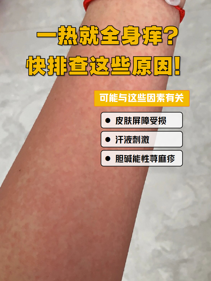 为什么全身很痒