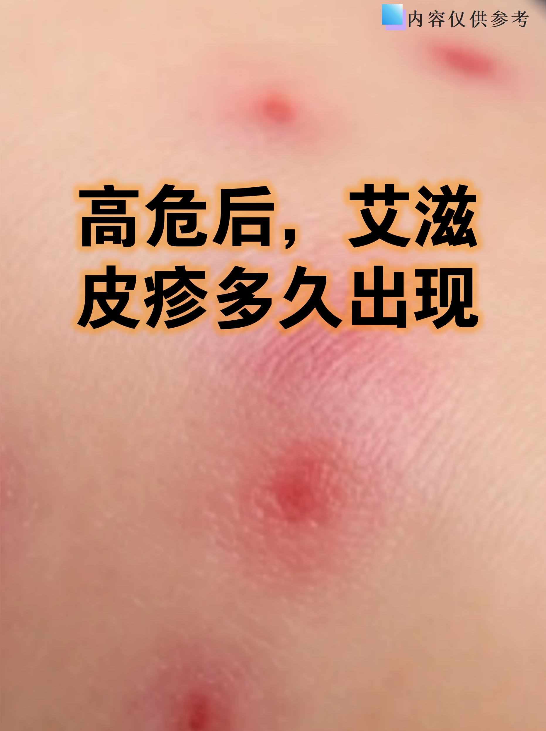  最近病毒感染的症状有哪些图片和症状(最新的病毒感染的症状)