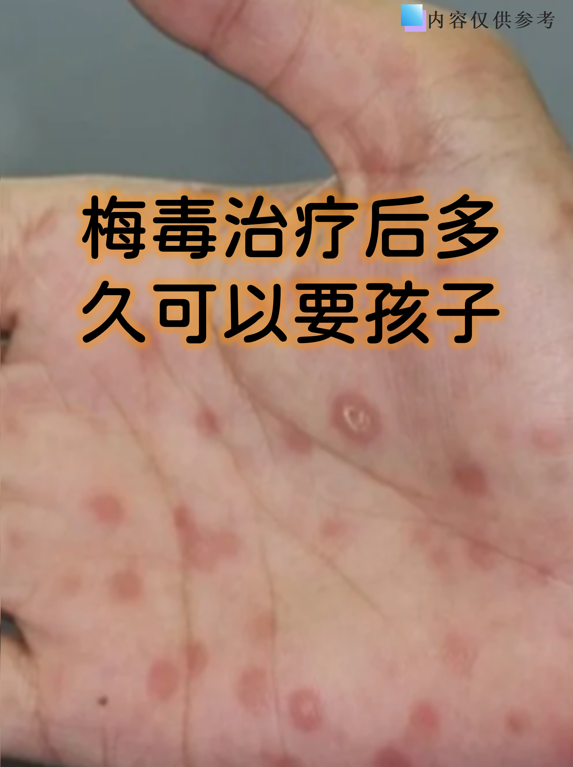 梅毒治愈标准 血清学转阴:治疗后需定期复