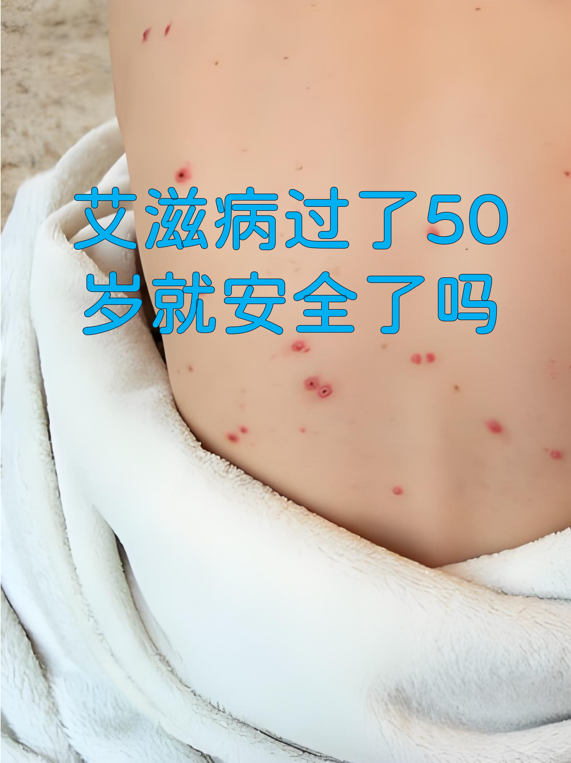  高危病毒能治好吗(高危病毒怎么治治疗彻底转阴)