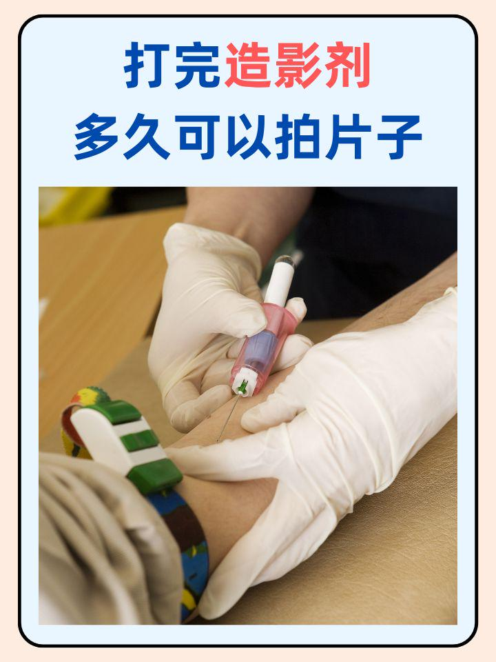 今天我们要聊一聊一个非常实用的话题