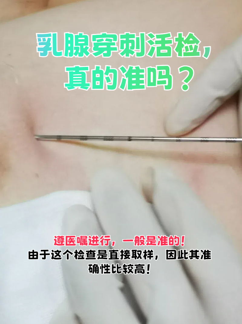 首先,我来解答大家最关心的问题:乳腺穿刺活检准确吗?答案是:准确!