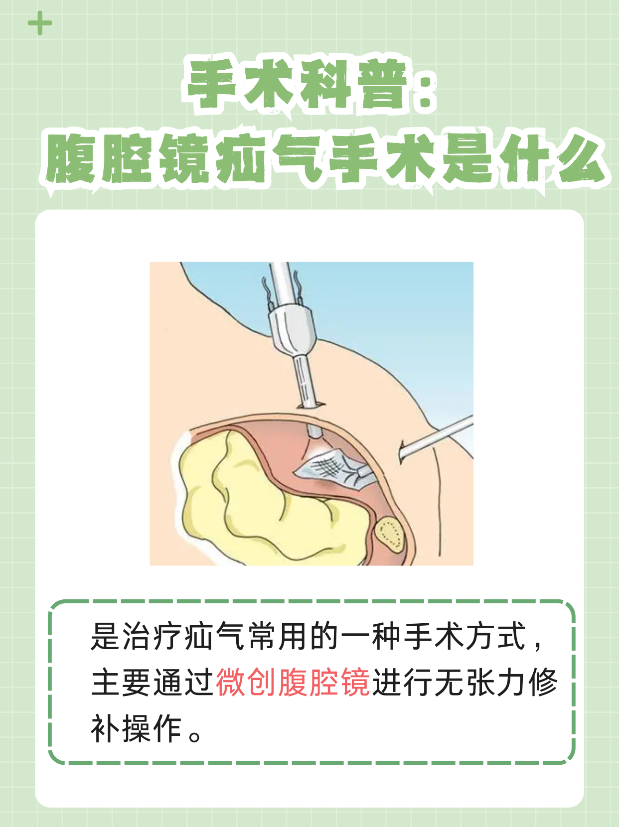 小猪脐疝的治疗方法图图片