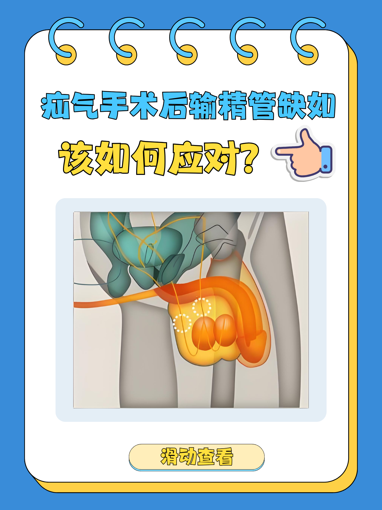 1首先,要明确输精管缺如的原因.