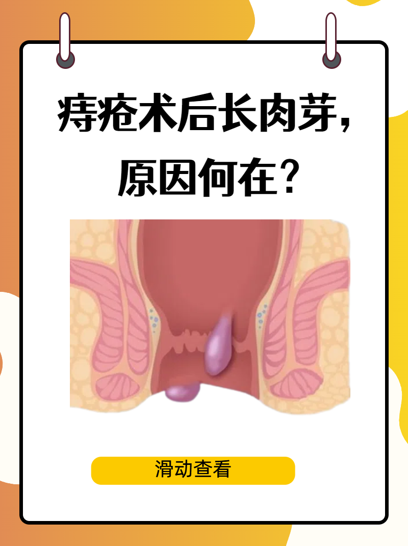 痔疮手术后,不少患者会发现伤口周围长出了肉芽,这究竟是怎么回守呢